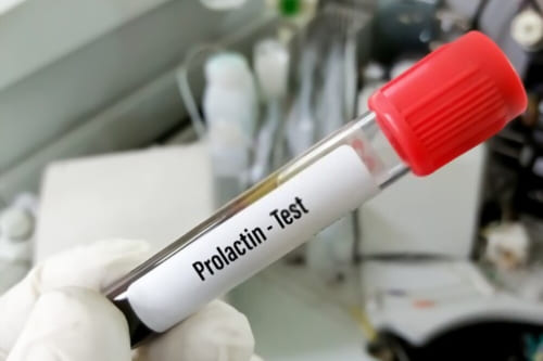 Tratamiento de hiperprolactinemia (elevación de prolactina)