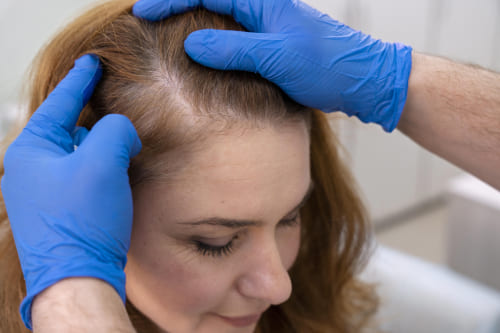 Tratamiento de tumores productores de andrógenos