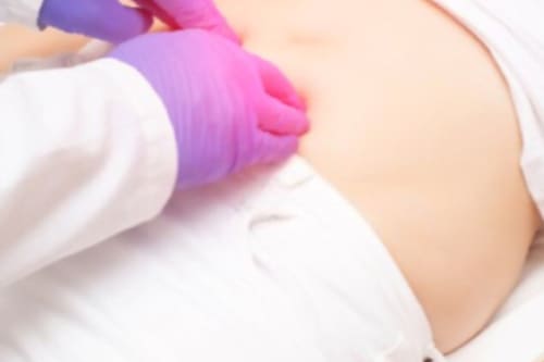 Tratamiento de absceso pélvico