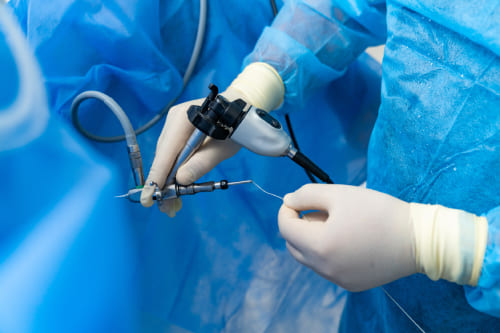 Histerectomía laparoscópica