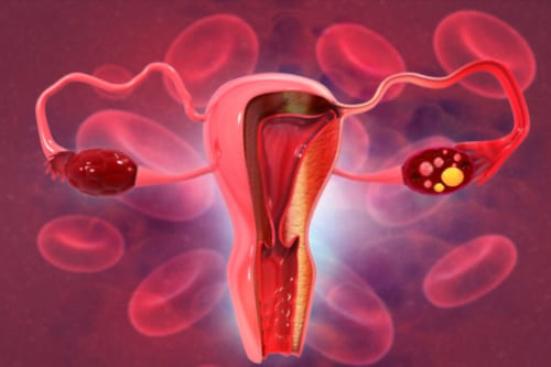 Tratamiento de sangrado uterino anormal