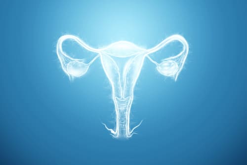 Tratamiento de hidrosalpinx