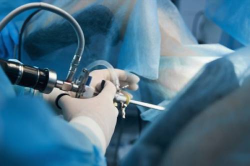 Histeroscopia quirúrgica