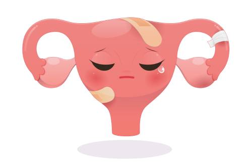 Corrección de malformaciones uterinas (mullerianas)