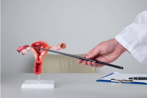 Cierre de ostiums por histeroscopia