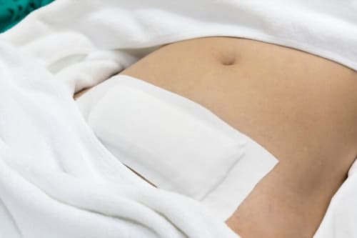 Histerectomía laparoscópica