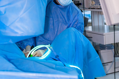 Salpingectomía por laparoscopia