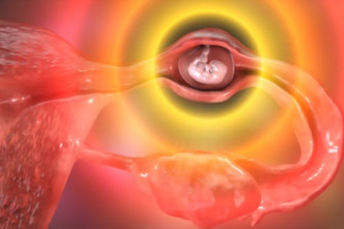 Tratamiento de embarazo ectópico por laparoscopia