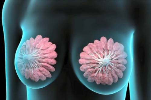 Tratamiento de ectasia ductal