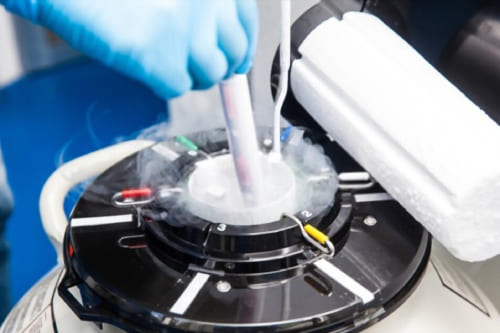 Criopreservación de óvulos y espermatozoides en pacientes con cáncer