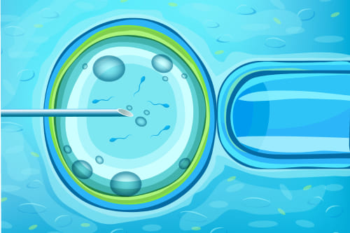 Fertilización in vitro