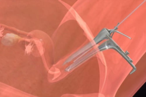 Transferencia de embriones