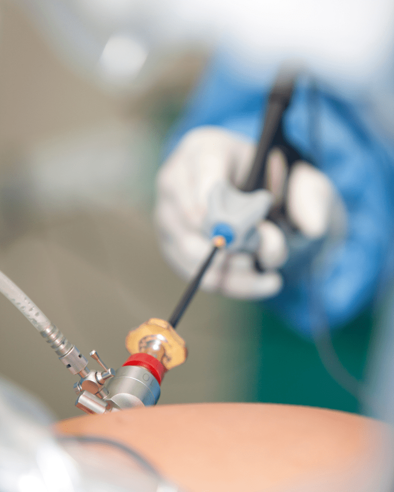 ginecologo-especialista-en-cirugia-laparoscopica